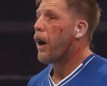 Jake Hager Underwent Additional Surgery to Reattach Retina After Power Slap Loss